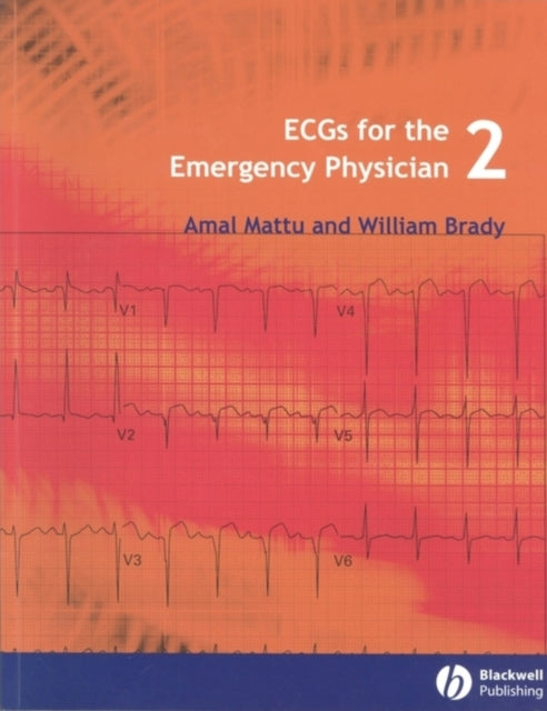 Book cover of: ECGs for the Emergency Physician 2. By: Amal Mattu