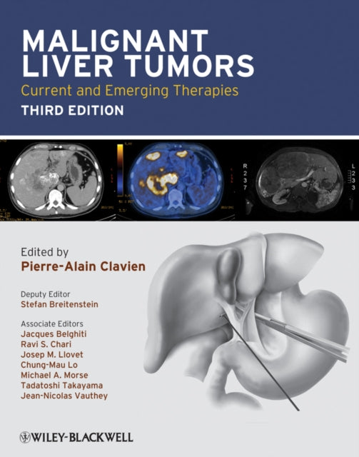 Book cover of: Malignant Liver Tumors. By: Pierre-Alain Clavien