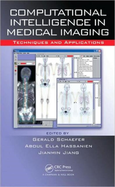 Book cover of: Computational Intelligence in Medical Imaging
