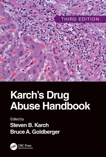 Book cover of: Karch's Drug Abuse Handbook. By: Steven B. Karch