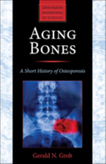 Book cover of: Aging Bones