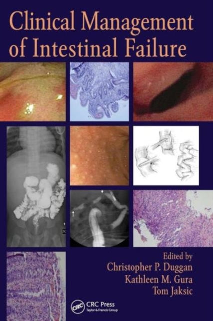 Book cover of: Clinical Management of Intestinal Failure. By: Duggan, Christopher MD