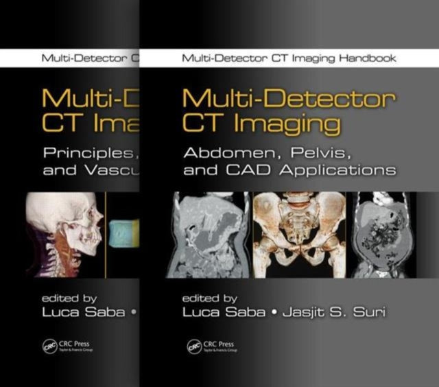 Book cover of: Multi-Detector CT Imaging Handbook, Two Volume Set