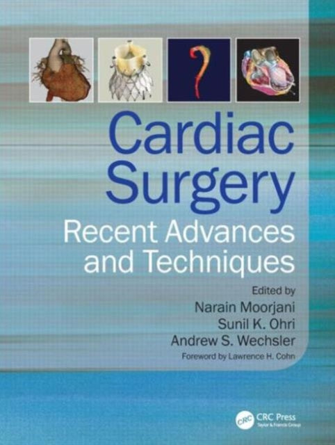 Book cover of: Cardiac Surgery. By: Narain Moorjani