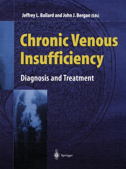 Book cover of: Chronic Venous Insufficiency. By: Jeffrey L. Ballard