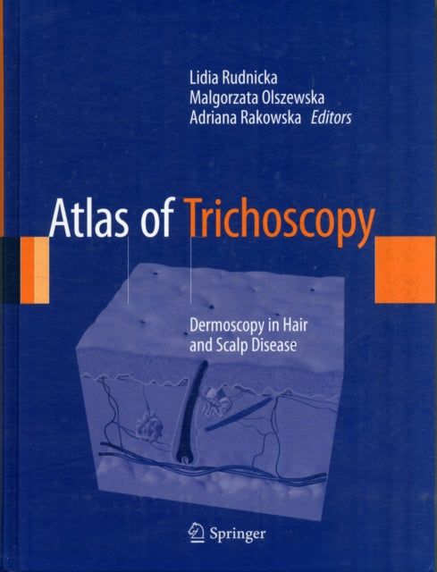 Book cover of: Atlas of Trichoscopy