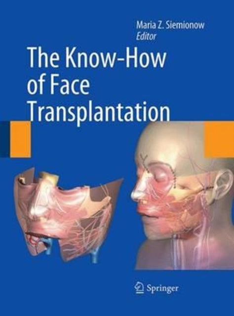 Book cover of: Know-How of Face Transplantation. By: Maria Z. Siemionow