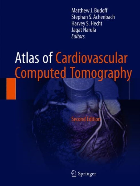 Book cover of: Atlas of Cardiovascular Computed Tomography. By: Matthew J. Budoff