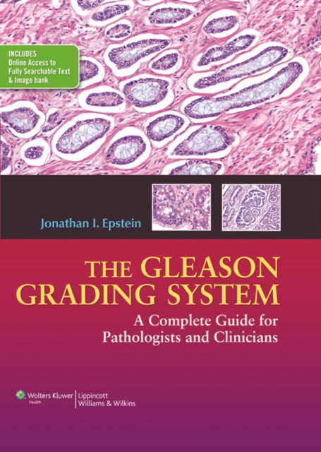 Book cover of: Gleason Grading System. By: Jonathan I. Epstein