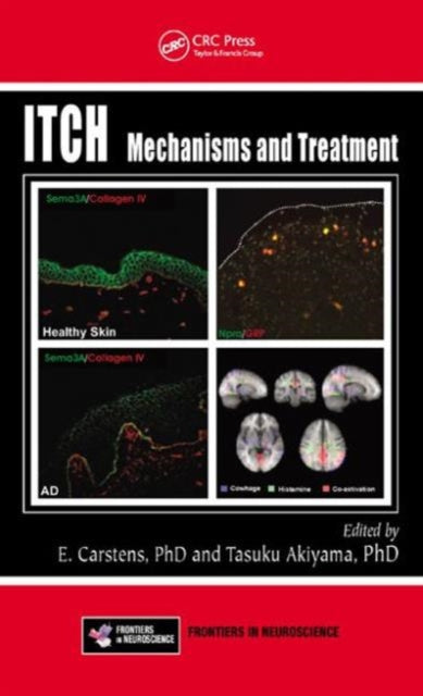 Book cover of: Itch. By: Earl E. Carstens