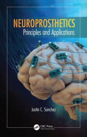Neuroprosthetics