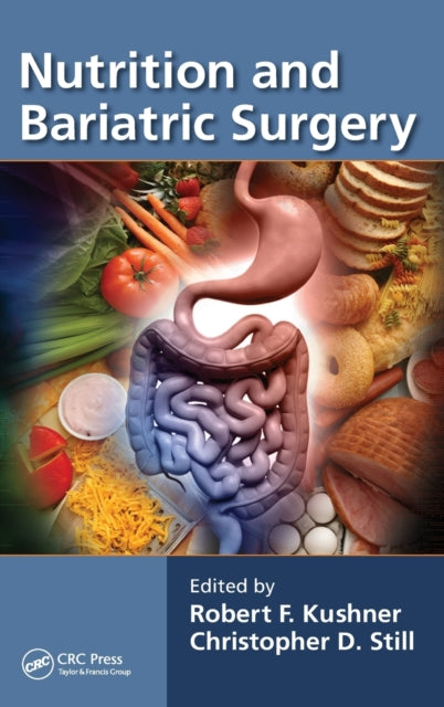 Book cover of: Nutrition and Bariatric Surgery. By: Robert F. Kushner