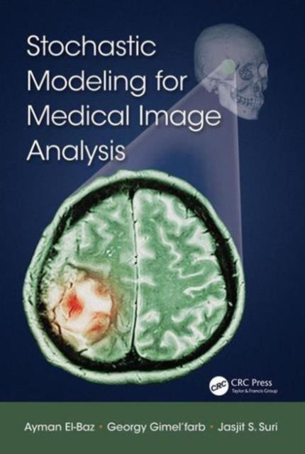 Book cover of: Stochastic Modeling for Medical Image Analysis. By: Ayman El-Baz