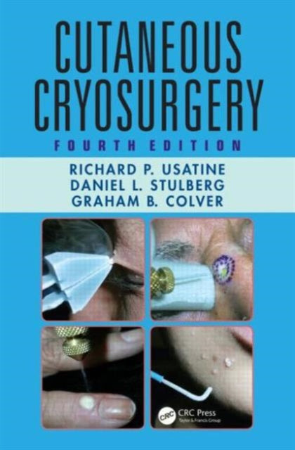 Book cover of: Cutaneous Cryosurgery. By: Richard P. Usatine