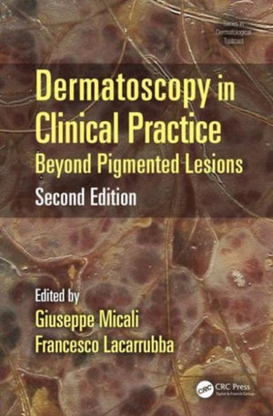 Dermatoscopy in Clinical Practice