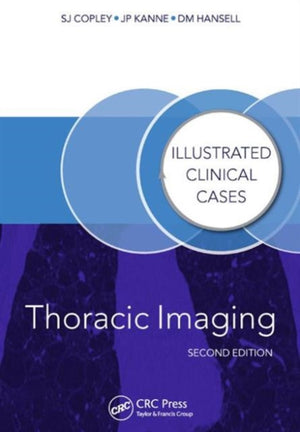 Thoracic Imaging