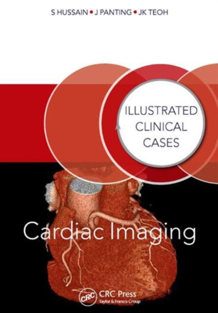 Book cover of: Cardiac Imaging. By: Shahid Hussain
