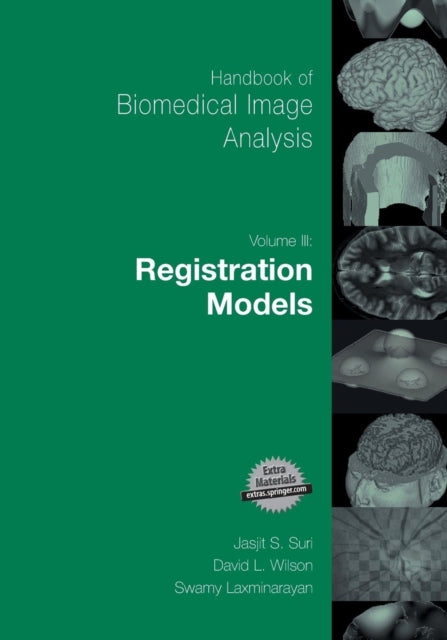 Book cover of: Handbook of Biomedical Image Analysis. By: David Wilson