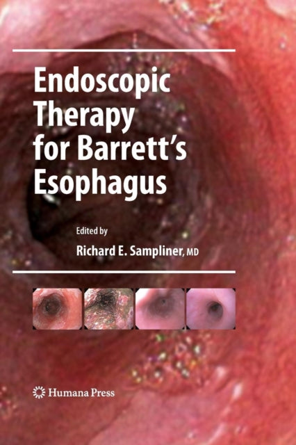 Book cover of: Endoscopic Therapy for Barrett's Esophagus. By: Richard E. Sampliner