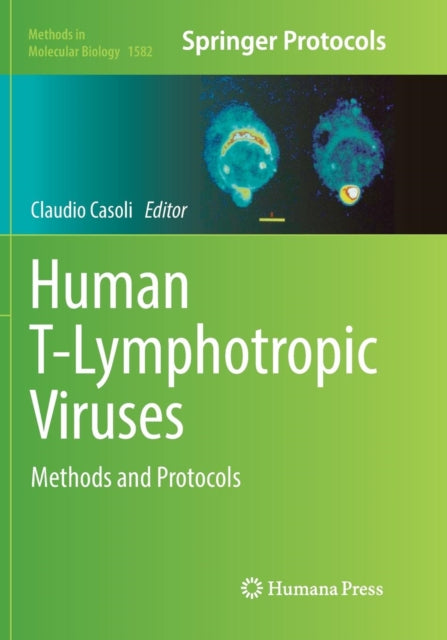 Book cover of: Human T-Lymphotropic Viruses. By: Claudio Casoli