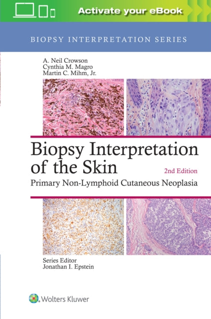 Book cover of: Biopsy Interpretation of the Skin. By: A. Neil Crowson MD