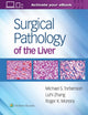 Book cover of: Surgical Pathology of the Liver. By: Michael Torbenson MD