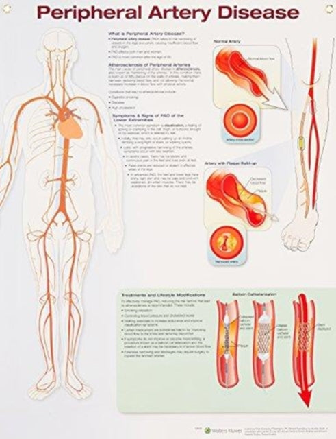 Book cover of: Peripheral Artery Disease