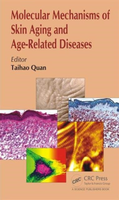 Book cover of: Molecular Mechanisms of Skin Aging and Age-Related Diseases. By: Taihao Quan