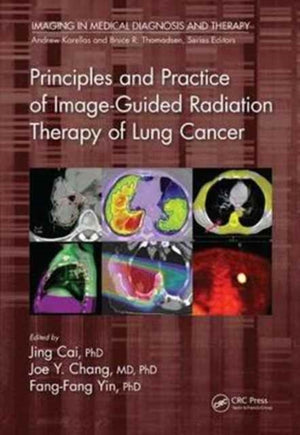 Principles and Practice of Image-Guided Radiation Therapy of Lung Cancer