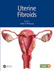 Book cover of: Uterine Fibroids. By: John C. Petrozza