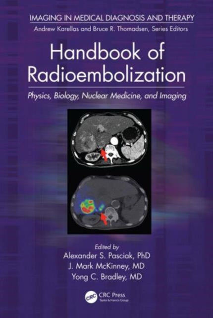 Book cover of: Handbook of Radioembolization. By: Alexander S. Pasciak