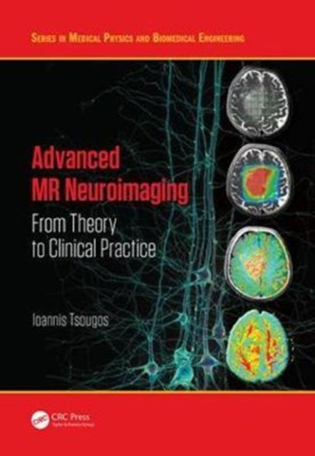 Book cover of: Advanced MR Neuroimaging. By: Ioannis Tsougos