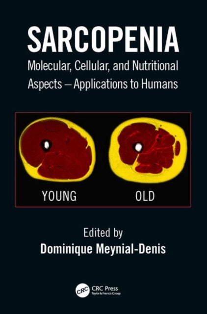 Book cover of: Sarcopenia. By: Dominique Meynial-Denis
