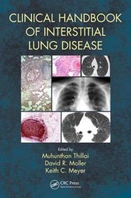 Book cover of: Clinical Handbook of Interstitial Lung Disease. By: Muhunthan Thillai