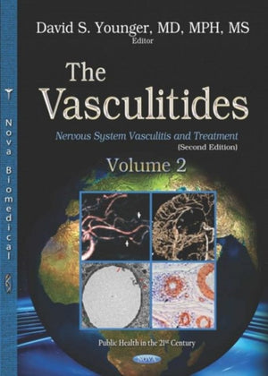 Vasculitides
