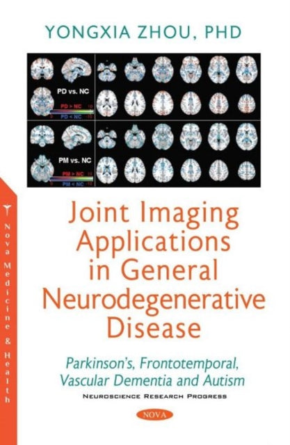 Book cover of: Joint Imaging Applications in General Neurodegenerative Disease. By: Yongxia Zhou