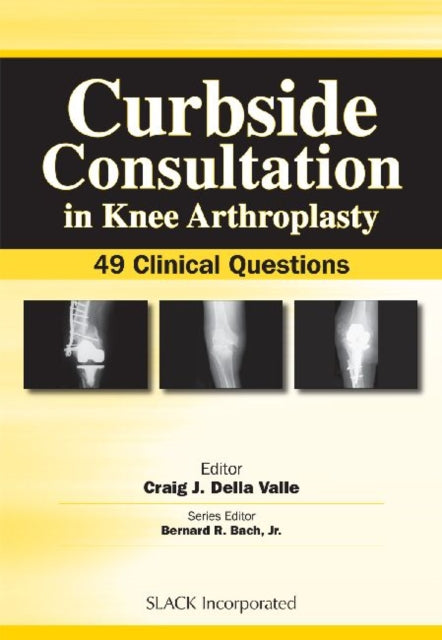 Book cover of: Curbside Consultation in Knee Arthroplasty