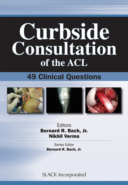 Book cover of: Curbside Consultation of the ACL