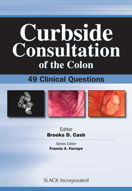 Book cover of: Curbside Consultation of the Colon. By: Brookes D. Cash
