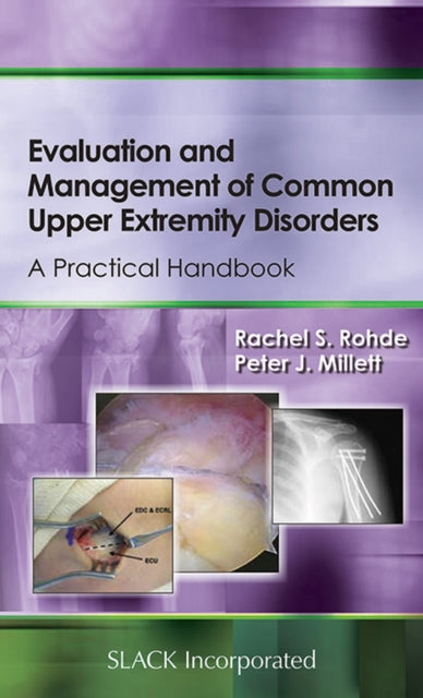 Book cover of: Evaluation and Management of Common Upper Extremity Disorders. By: Rachel S. Rohde