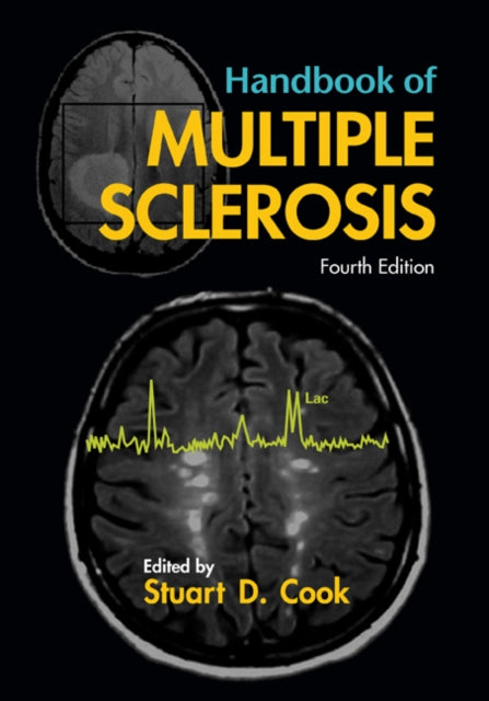 Book cover of: Handbook of Multiple Sclerosis. By: Stuart D. Cook