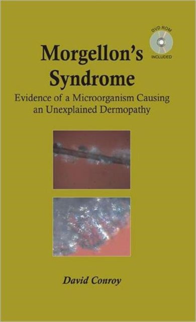 Book cover of: Morgellon's Syndrome. By: David Conroy