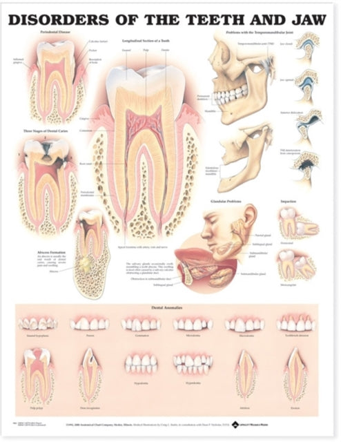 Book cover of: Disorders of the Teeth and Jaw Anatomical Chart. By: Anatomical Chart Company