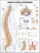 Book cover of: Human Spine Disorders Anatomical Chart. By: Anatomical Chart Company