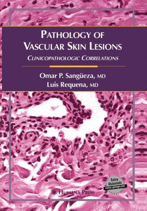 Pathology of Vascular Skin Lesions