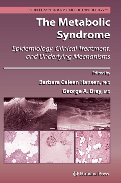 Book cover of: Metabolic Syndrome: