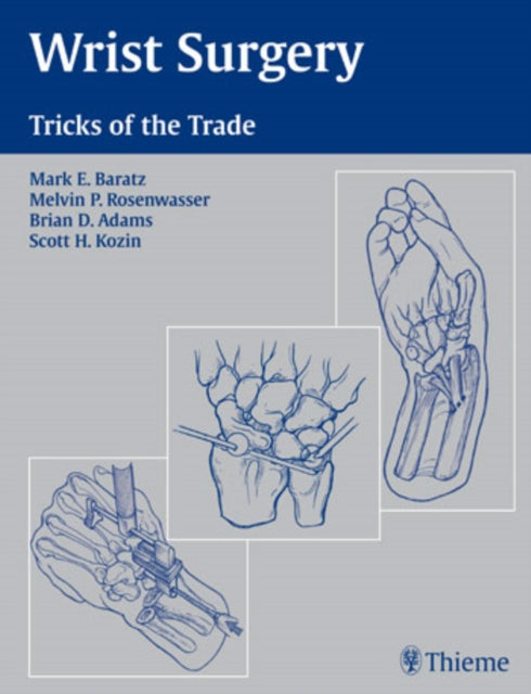 Book cover of: Wrist Surgery. By: Mark E., M.D. Baratz