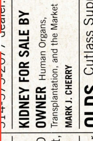 Kidney for Sale by Owner