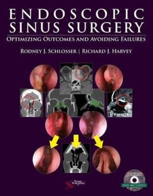 Book cover of: Endoscopic Sinus Surgery. By: Rodney J. Schlosser