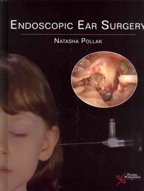 Book cover of: Endoscopic Ear Surgery. By: Natasha Pollak